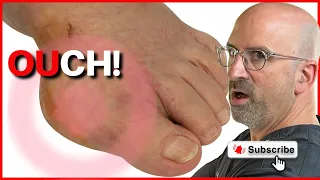 gOUT can take you OUT