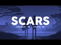 Download Lagu Keenan Te - Scars (Speed Up)| Lyrics Terjemahan ~ So i'll let you hold onto my heart