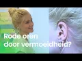 Download Lagu Worden je oren rood als je moe bent? | NOJ