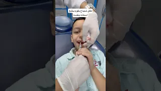 طفل شجاع يقوم بخلع أسنانه بنفسه A Brave Child Pulls Out His Own Tooth With Confidence Dr Sultan 