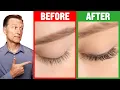 How to Grow Long Thick Eyelashes QUICKLY - Dr Berg