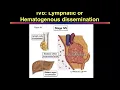 Download Lagu Management of Invasive Thymomas