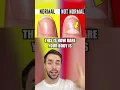 Download Lagu How RARE Is Your Body?!