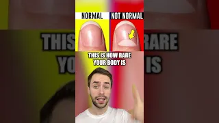 How RARE Is Your Body 