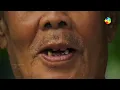पेट मे गैस कैसे बनती हैं? असली वजह आपको चौंका के रख देगा ! - how gas is formed in stomach