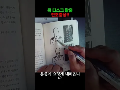 목 디스크 탈출 전조증상