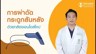 การผ่าตัดกระดูกสันหลังด้วยกล้องมีข้อดีอย่างไรบ้าง