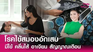  ไข้สมองอักเสบเกิดจากสาเหตุอะไรบ้าง 