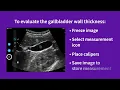 Vscan Air Using presets for evaluations gallbladder