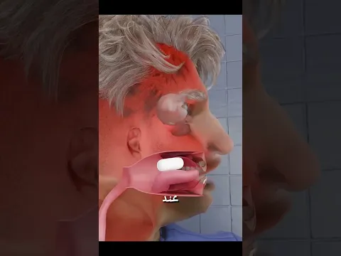 كبسولة مبتكرة لعلاج الإمساك بسرعة وفعالية #shortvideo