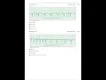 Relias Dysrhythmia Basic Test Answers 2025 Dysrhythmia - Basic A A GRADED 100 VERIFIED