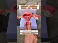 Download Lagu simulasi pembukaan Melahirkan - Medikacare