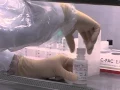 AFB Tuberculosis TB Specimen Processing