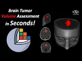 Brain Tumor Segmentation and Volume Assessment in 50 Seconds Using 3D Slicer