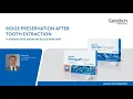 Download Lagu Ridge preservation after tooth extraction in alveouls with preserved buccal bone wall
