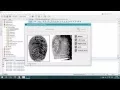 Fingerprint Classification Pattern Recognition
