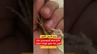 علاج جرح الارجل الطيور الكناري او اي طائر فقط بهذا الدواء الغني عن التعريف   دندنها