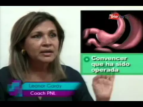 Banda gástrica virtual nueva opción para bajar de peso