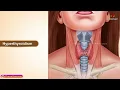 Hyperthyroidism Part 1 Etiology Types Clinical manifestations Diagnosis and Treatment