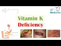Vitamin K Deficiency Dietary Sources Causes Symptoms Diagnosis Treatment