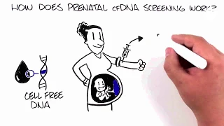 Prenatal Screening Options cfDNA cell free DNA