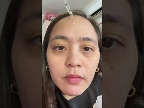 Mommy! Kung matagal ka ng may dark spot at acne mark sa face…