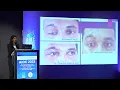 Download Lagu AIOC 2023 FP1302  Trauma topic Dr DR  SINDHUJA MURUGESAN Retrospective study on management of trauma