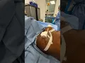Tummy Tuck Lipo Breasts All In One Transformation with Dr Curves