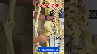  อาการเจ็บที่ก้นเวลาที่นั่งนาน ๆ เป็นเพราะอะไร 