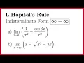L Hopital s Rule Infinity Minus Infinity Indeterminate Form