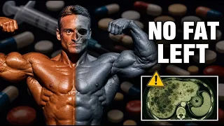 The Man Who Had No Fat Left The Andreas Munzer Story
