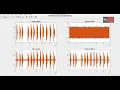 Audio File Restoration Using Wiener Filter Image Processing Matlab