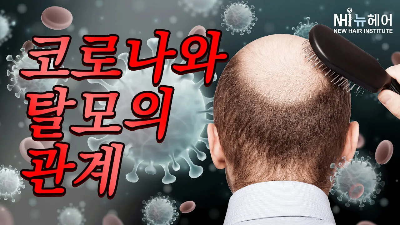 코로나19 남성 탈모와 연관이 있다고?? - 뉴헤어 I 탈모치료