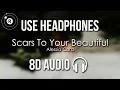 Download Lagu Alessia Cara - Scars To Your Beautiful (8D AUDIO)