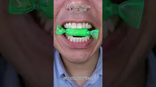 The Most Satisfying Chocolate & Candy ASMR Compilation