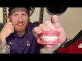 Easy Dentures MUST WATCH Dentures Unboxing How To