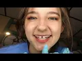 Download Lagu Relaxing Dental Hygienist ASMR Roleplay🦷Calming Teeth Cleaning \u0026 Whispered Instructions - Aftny Rose