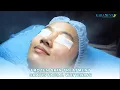 Download Lagu NEW! Frozen Skin Treatment +GRATIS Facial Whitening - Karadenta House Of Beauty