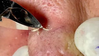 Satisfying video with Chung Vo Spa | 423
