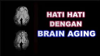 PENUAAN DAN PENYUSUTAN OTAK / BRAIN AGING DAN CARA MENCEGAHNYA