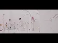 Cö shu Nie – asphyxia (Live) / “東京喰種トーキョーグール:re” OP
