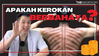 manfaat kerokan secara medis