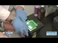 ANY LAB TEST NOW