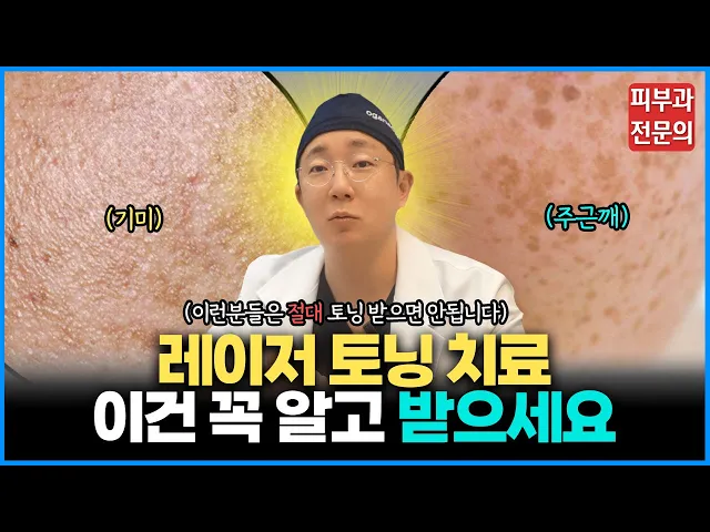 기미 색소치료 토닝 시술 전 꼭 확인하세요! 레이저토닝의 모든것 (Feat. 피코토닝)