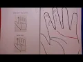 200 THE ULNAR AND RADIAL LOOPS