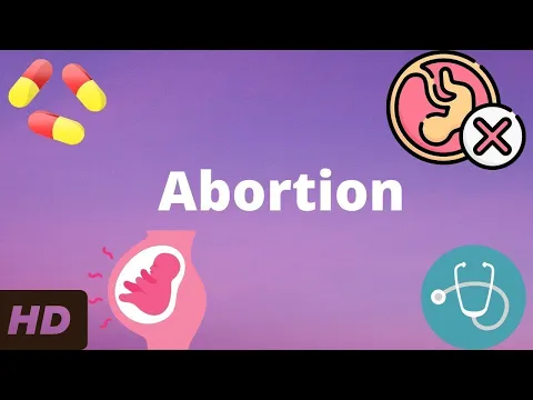 Download MP3 Abortion: Everything You Need To Know