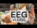 Download Lagu EEG VLOGG! - Följ med när jag gör 24h EEG