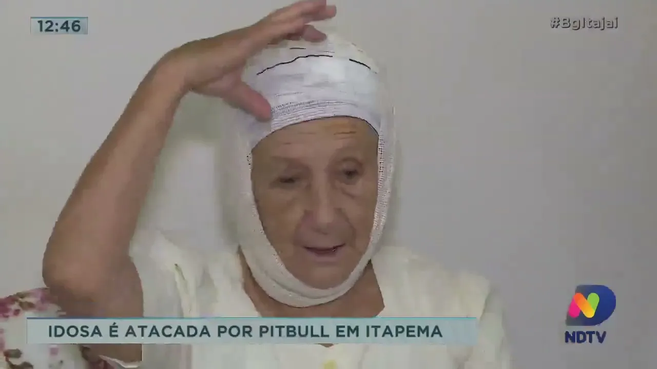 Idosa é atacada por pit bull em Itapema