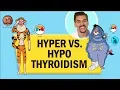 Short Hyperthyroidism vs Hypothyroid