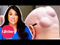 Download Lagu Cysts on Top of Cysts! | Dr. Pimple Popper: Breaking Out (S1) | Lifetime